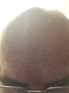 IMG_1219 bald head.JPG