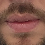 Luckylip